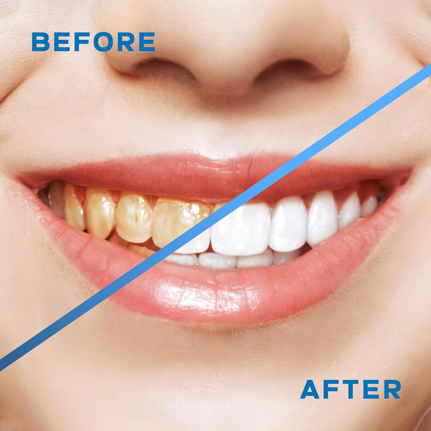 Irrigador Oral Inalámbrico Lianox LX-WF01 300ML 5 Modos IPX7