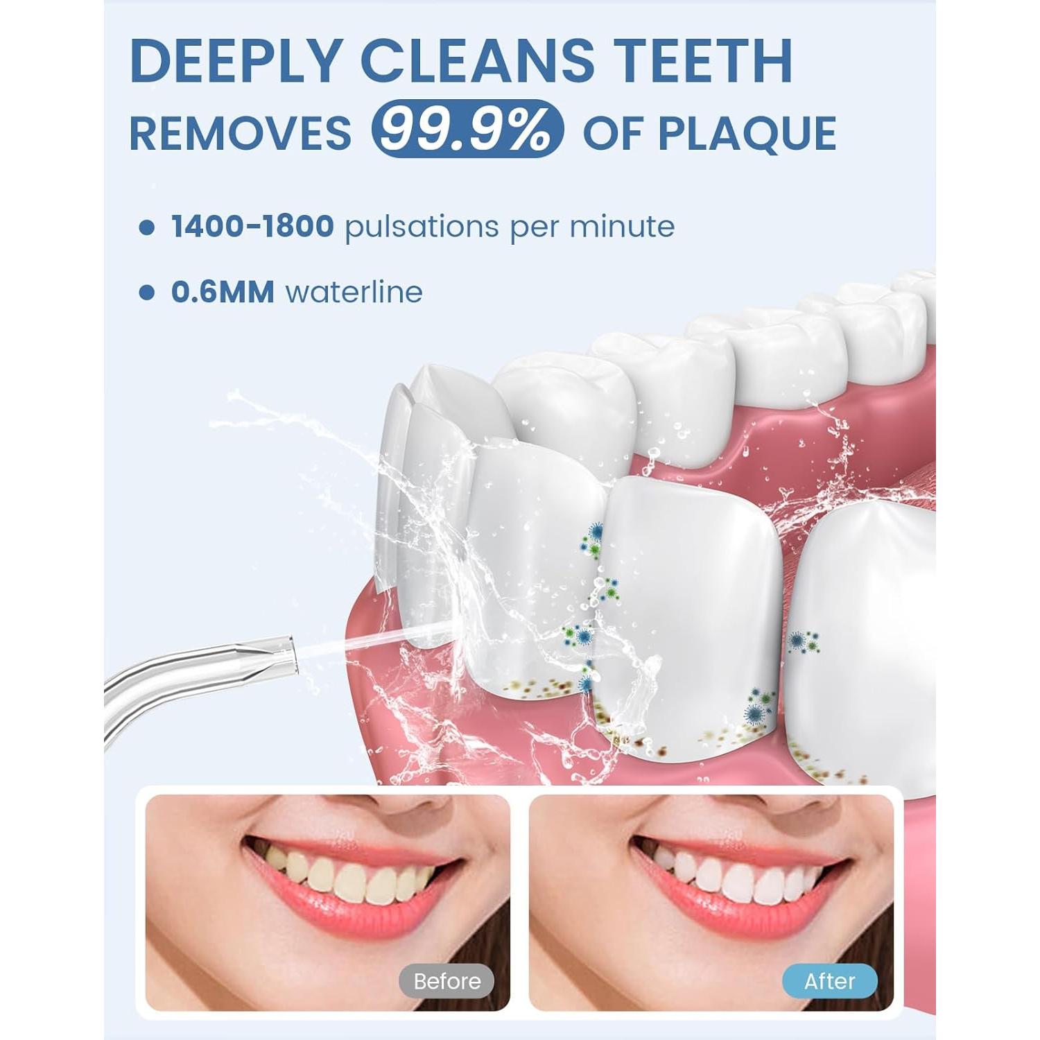 Irrigador Oral Inalámbrico AUIEI 300ml 5 Modos 9 Puntas Negro