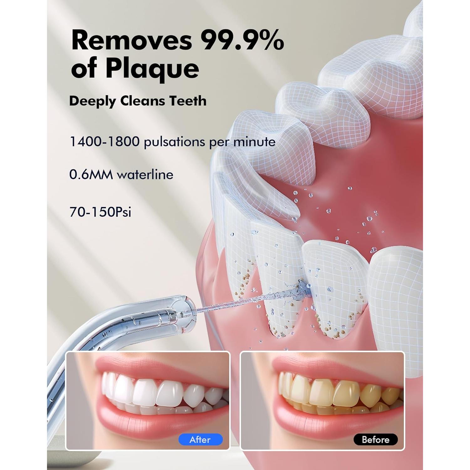 Irrigador Oral Inalámbrico Bezvoi Y215, 300ml, 5 Modos, IPX7