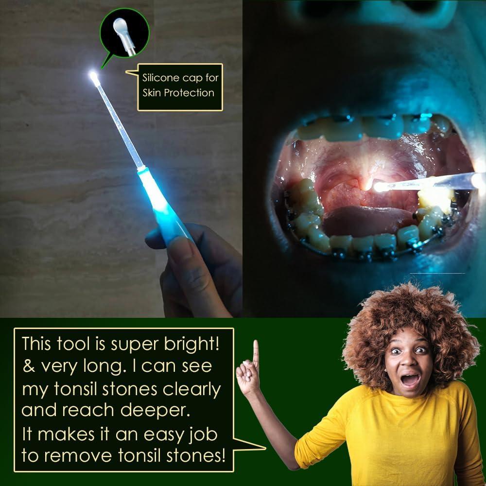 Extractor de Piedras de Amígdalas Airgoesin Azul con Luz LED