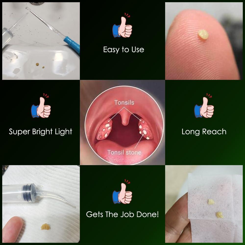 Extractor de Piedras de Amígdalas Airgoesin Azul con Luz LED