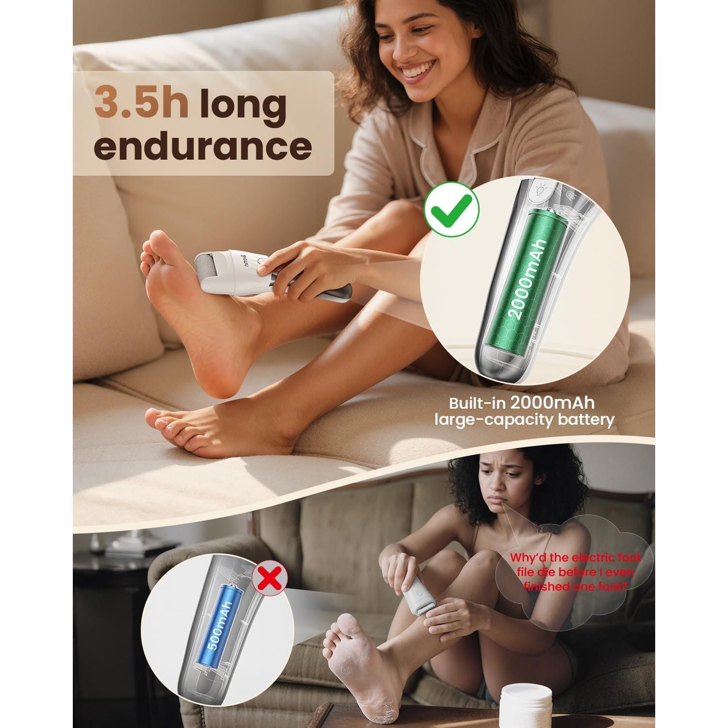 Removedor de Callos Eléctrico SVEMIN MJ-1 con Pantalla Digital