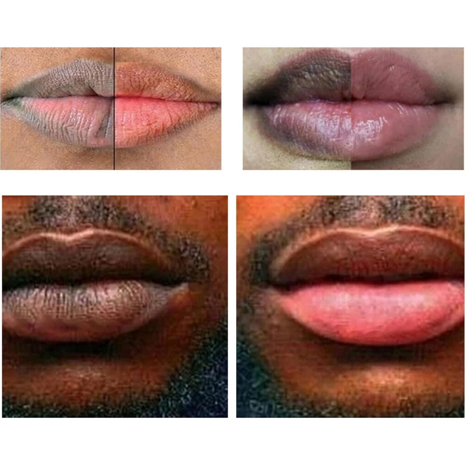 Bálsamo Labial Hidratante Aclarador de Cúrcuma 9g