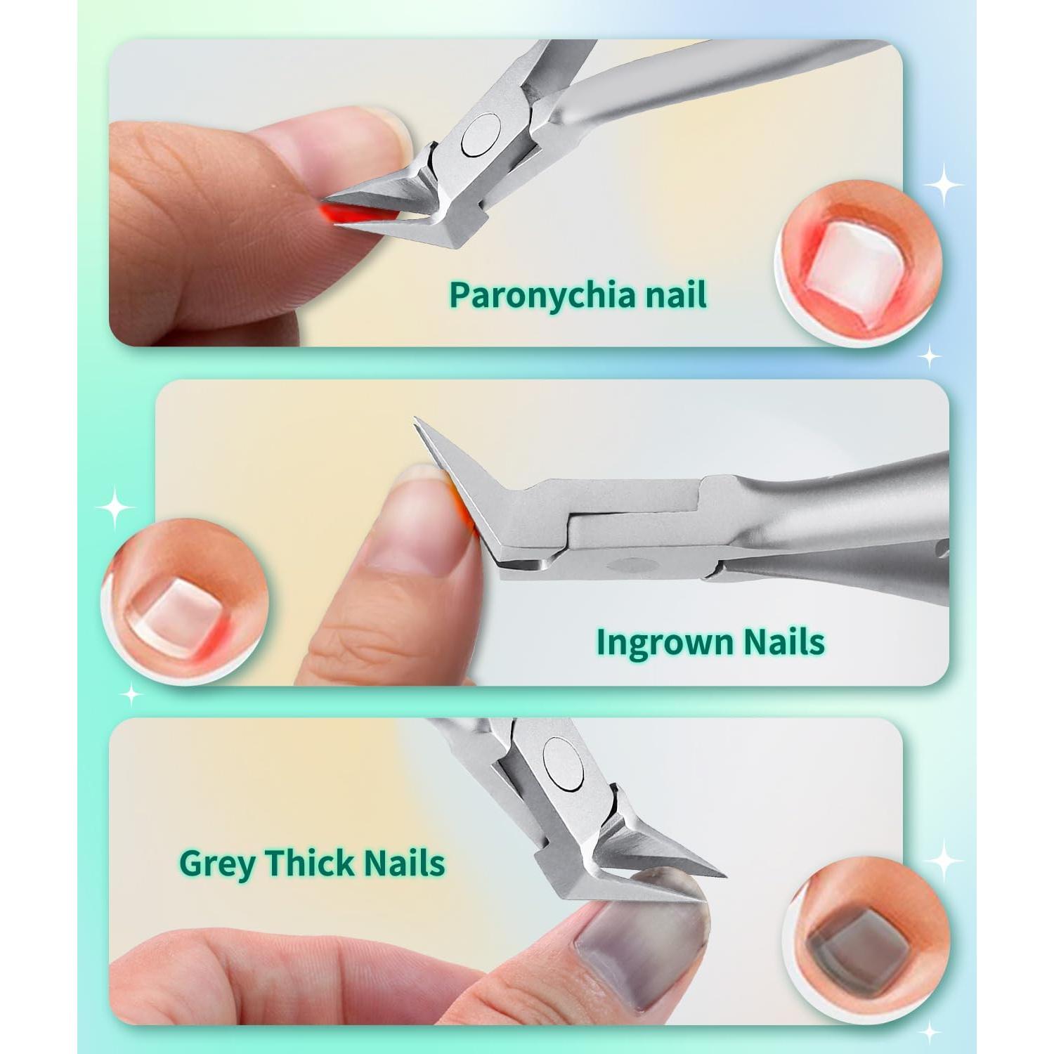 Cortador de Uñas Encarnadas ILLFER Acero Inoxidable Plata