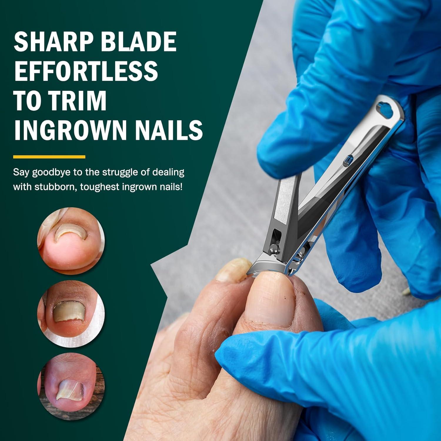 Cortauñas Curvado FVION para Uñas Encarnadas - Negro