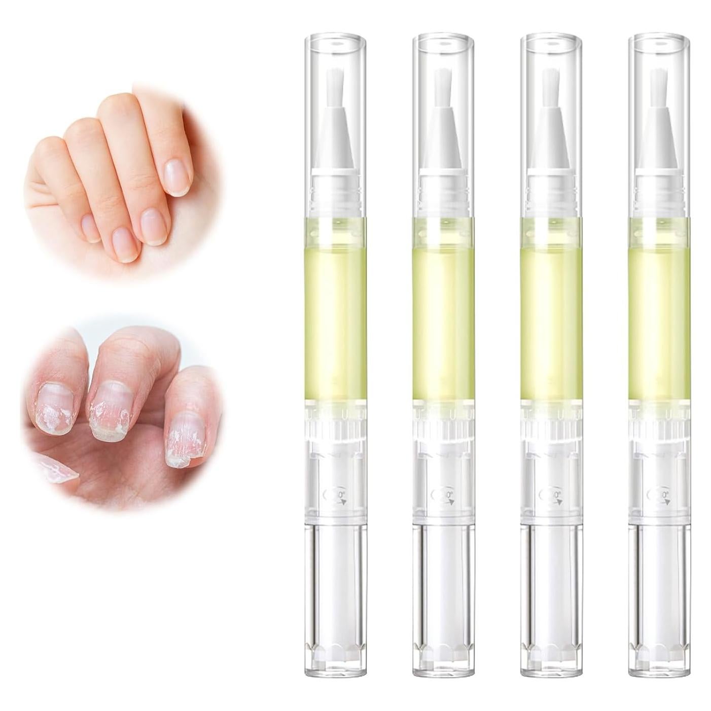 Aceite de Crecimiento de Uñas Radiante Nailz - 4 Pcs