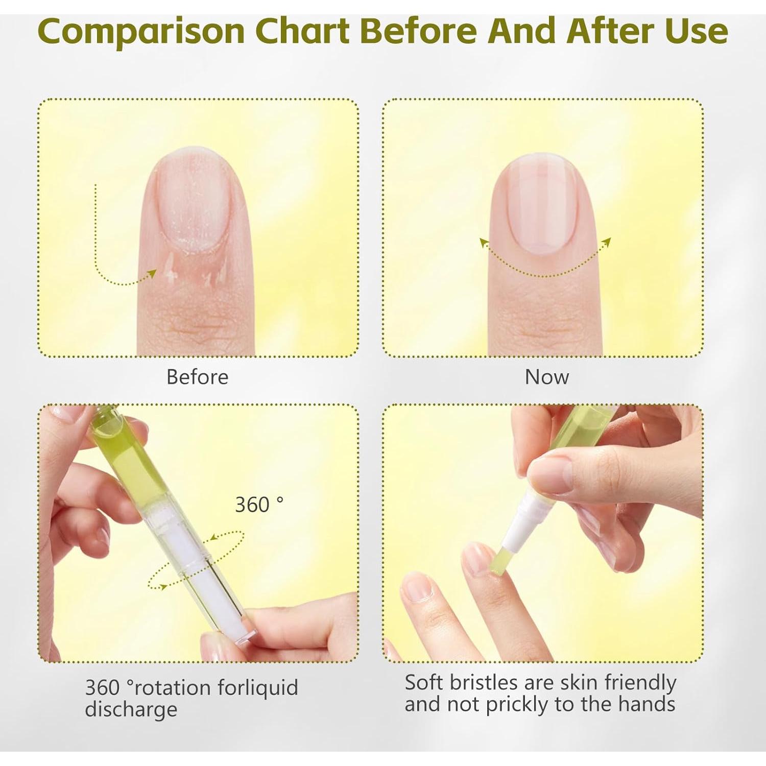 Aceite de Crecimiento de Uñas Radiante Nailz - 4 Pcs