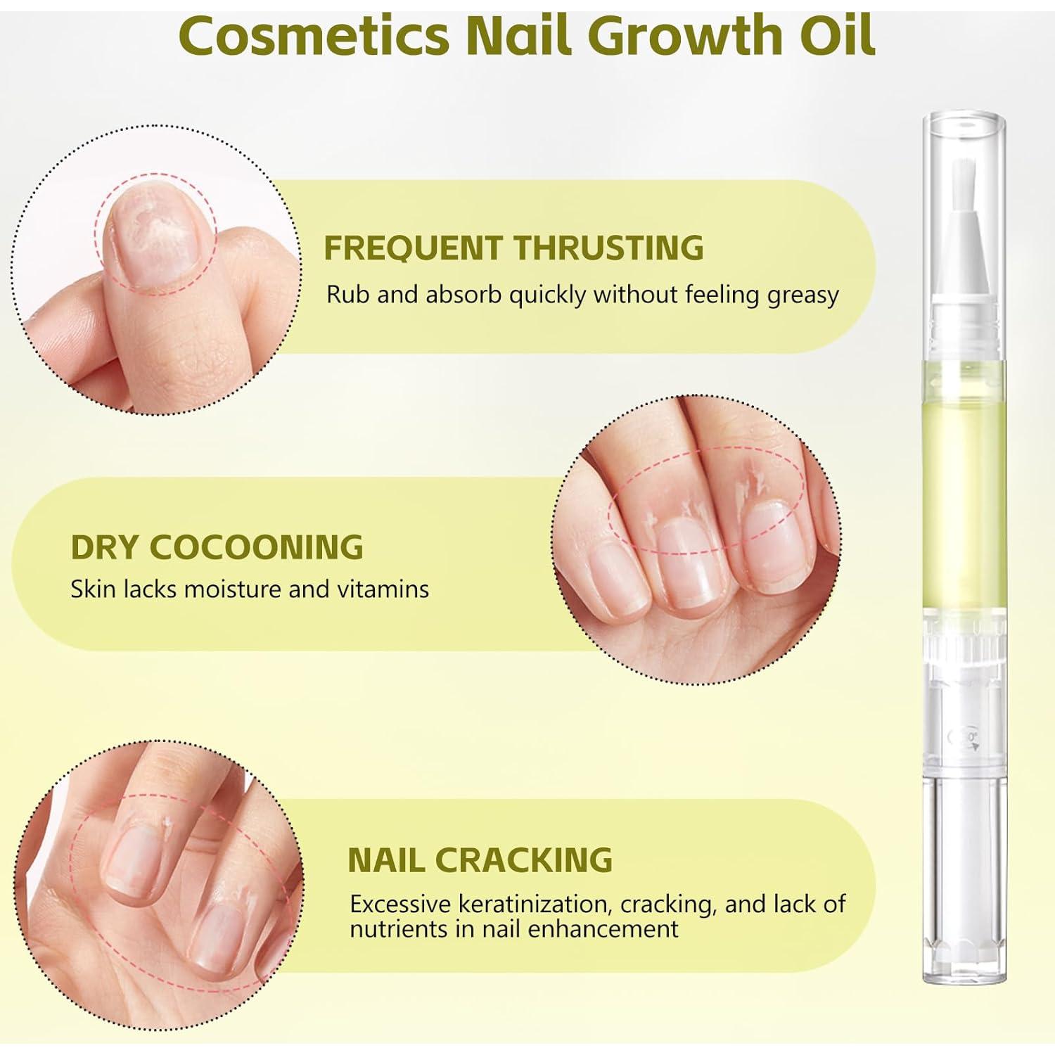 Aceite de Crecimiento de Uñas Radiante Nailz - 4 Pcs