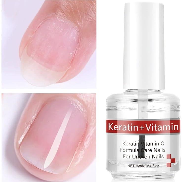 Aceite para Uñas y Cutículas Soelegant con Queratina y Vitaminas