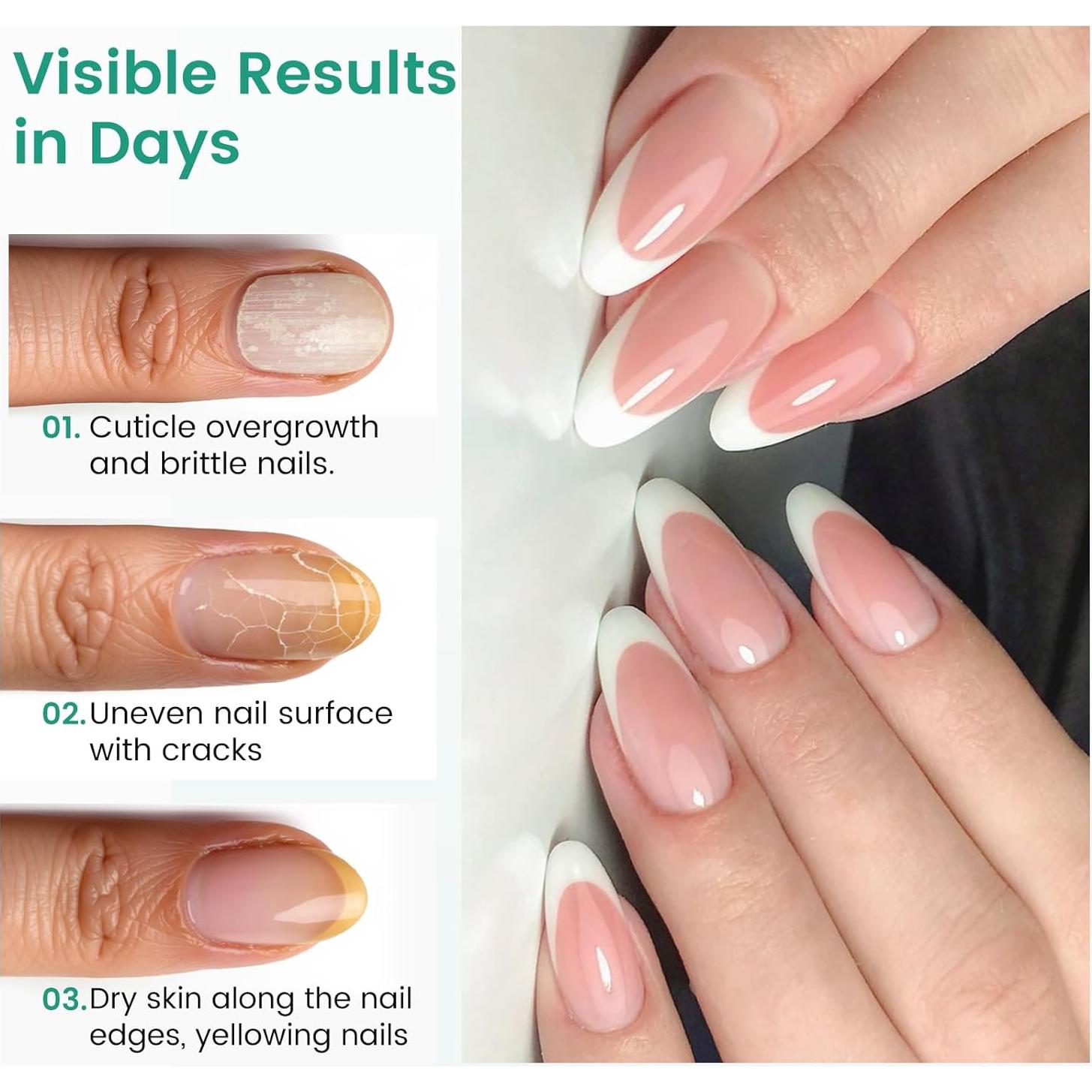 Bolígrafo Empujador de Cutículas Rosiour 3 en 1 Cerámica 12.7cm