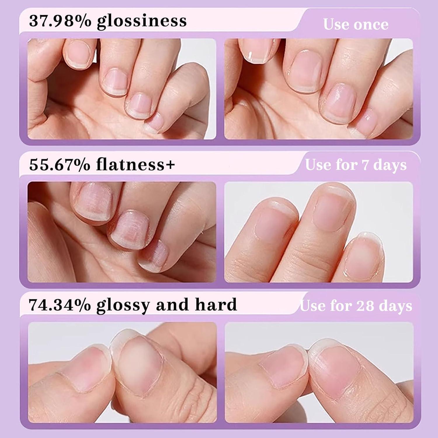 Bolígrafo de Cuidado de Uñas 3-en-1 Genérico con Punta de Cerámica