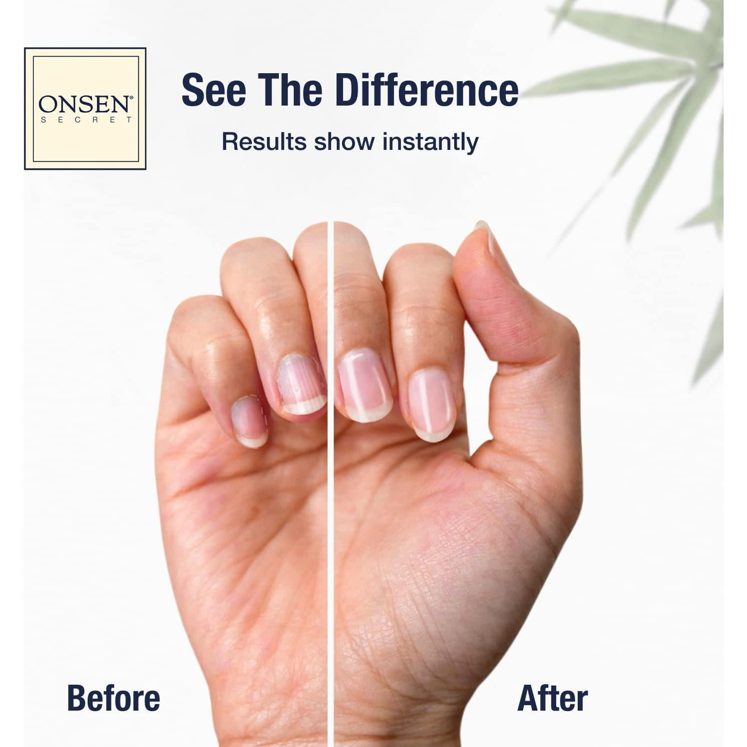 Pads de Reemplazo Onsen Secret para Bloque de Pulido de Uñas - 12 Unidades