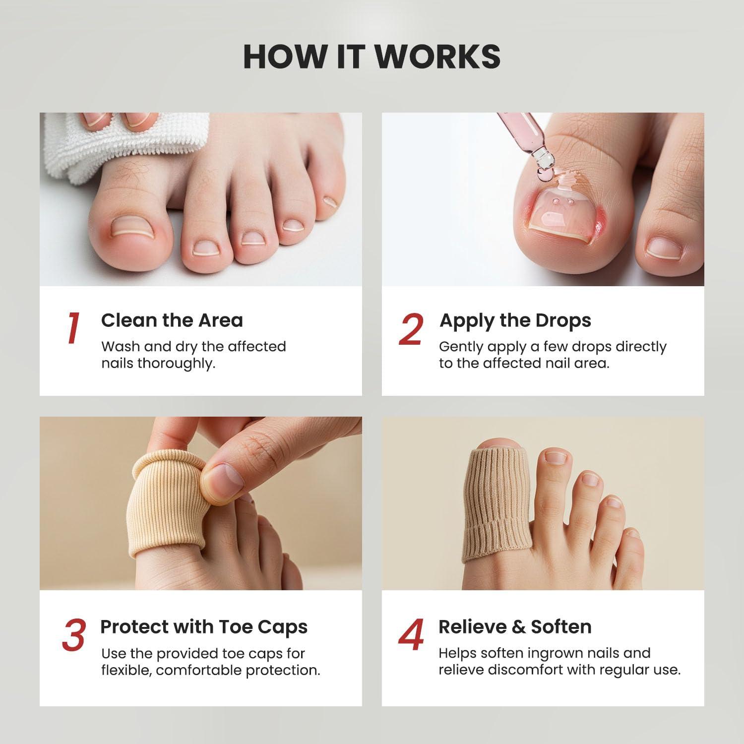 Kit Tratamiento Uñas Encarnadas Treatonic - Gotas y Tapas Silicona