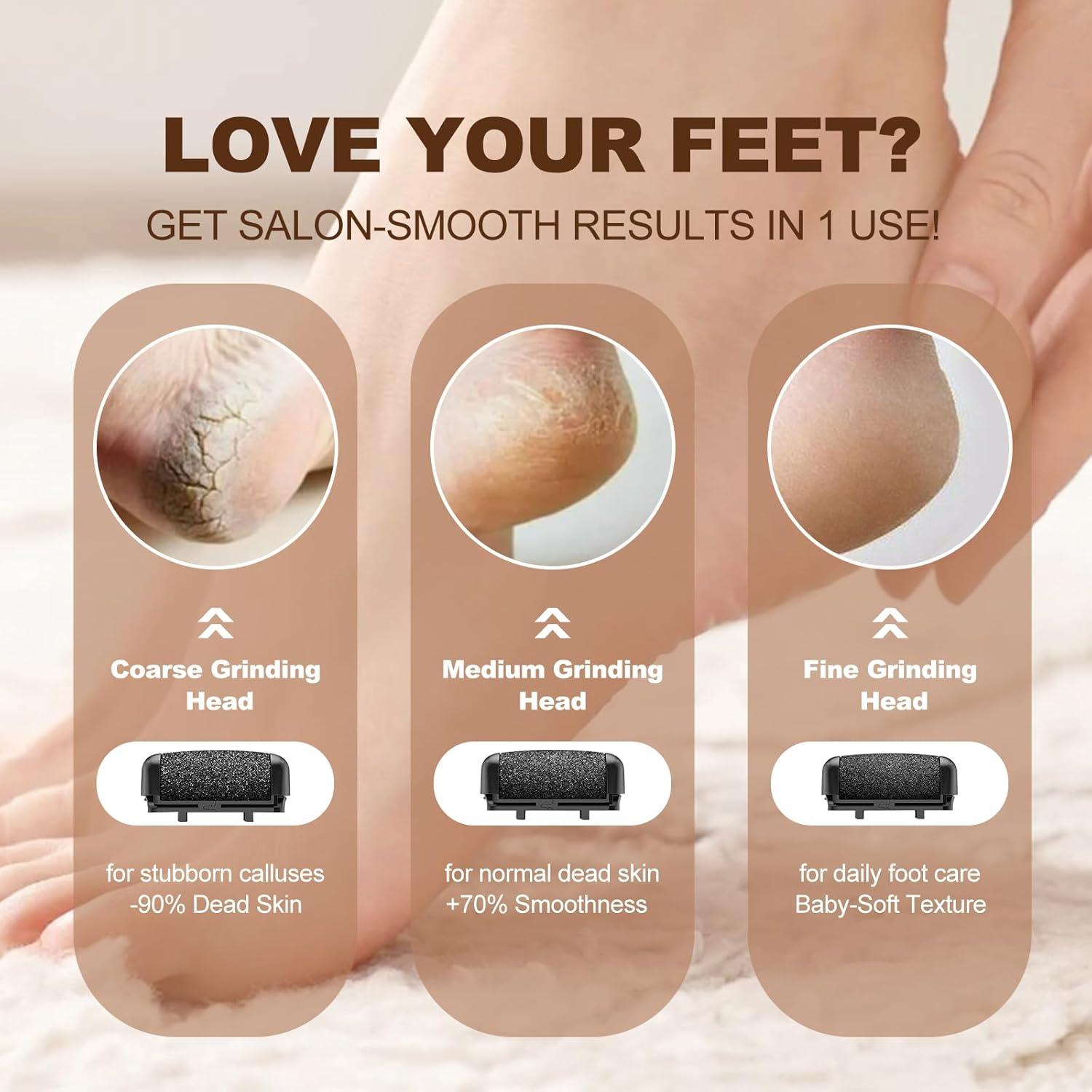 Removedor de Callos Eléctrico Zephiconn 17 en 1 Recargable