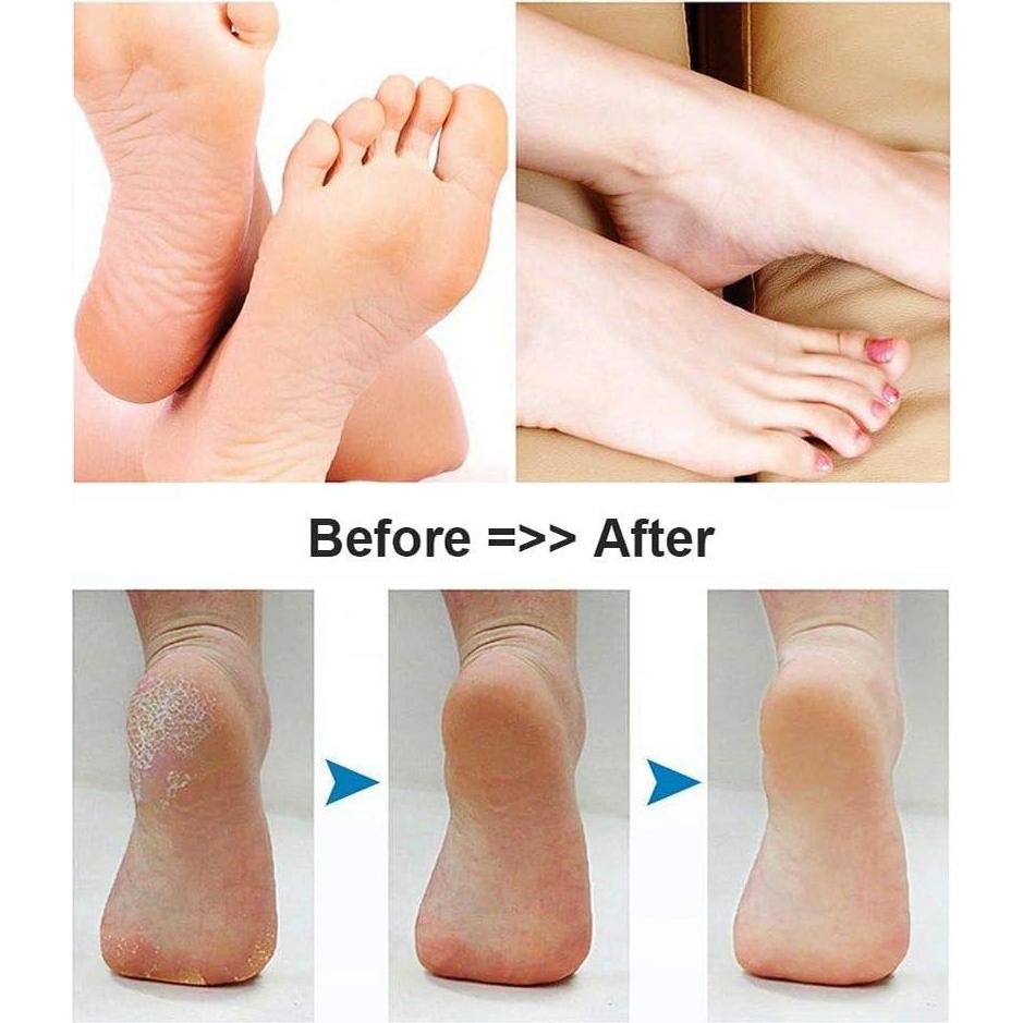 Lima Eléctrica para Pies BOMPOW Removedor de Piel Dura Negro