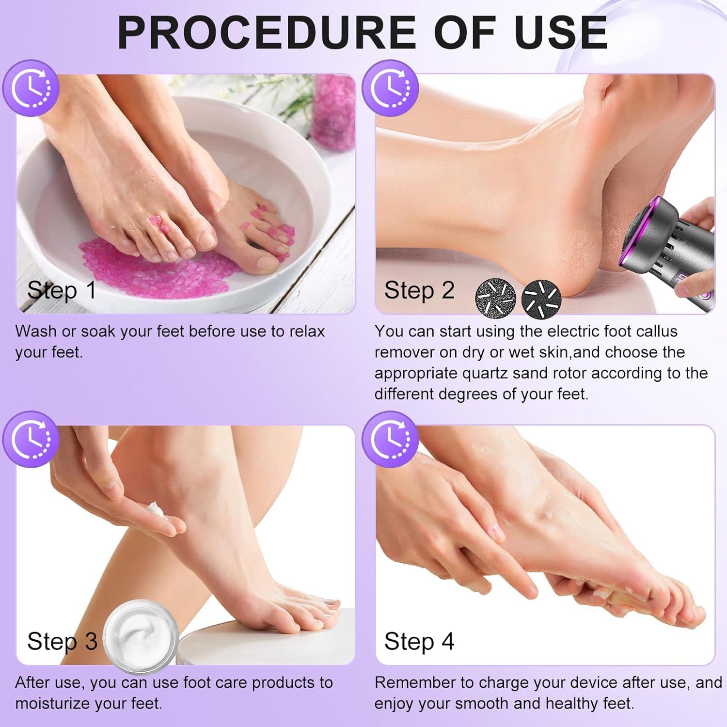 Removedor de Callos Eléctrico Recargable Yiyoujiapin 2025