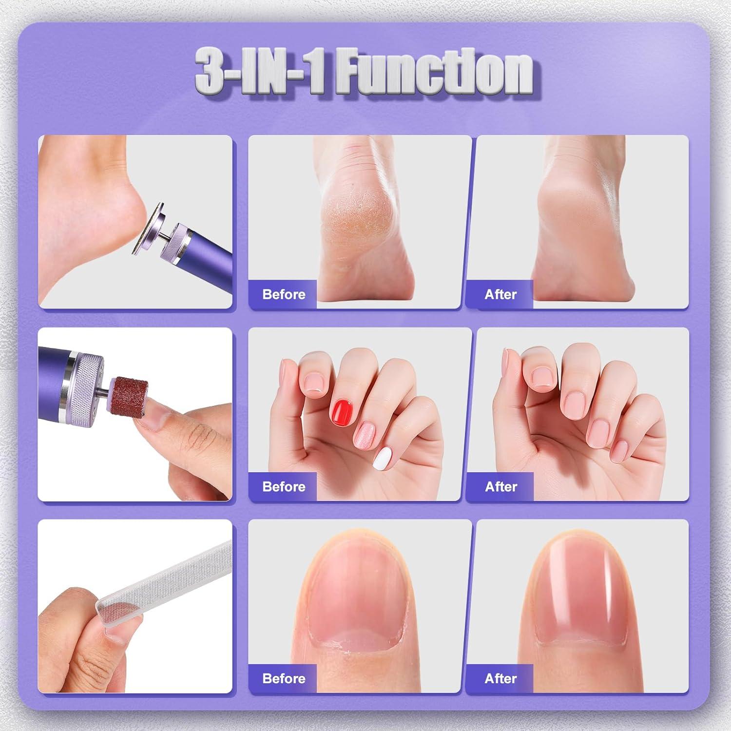 Removedor de Callos Eléctrico Butiblener MY-101 Inalámbrico 3 en 1