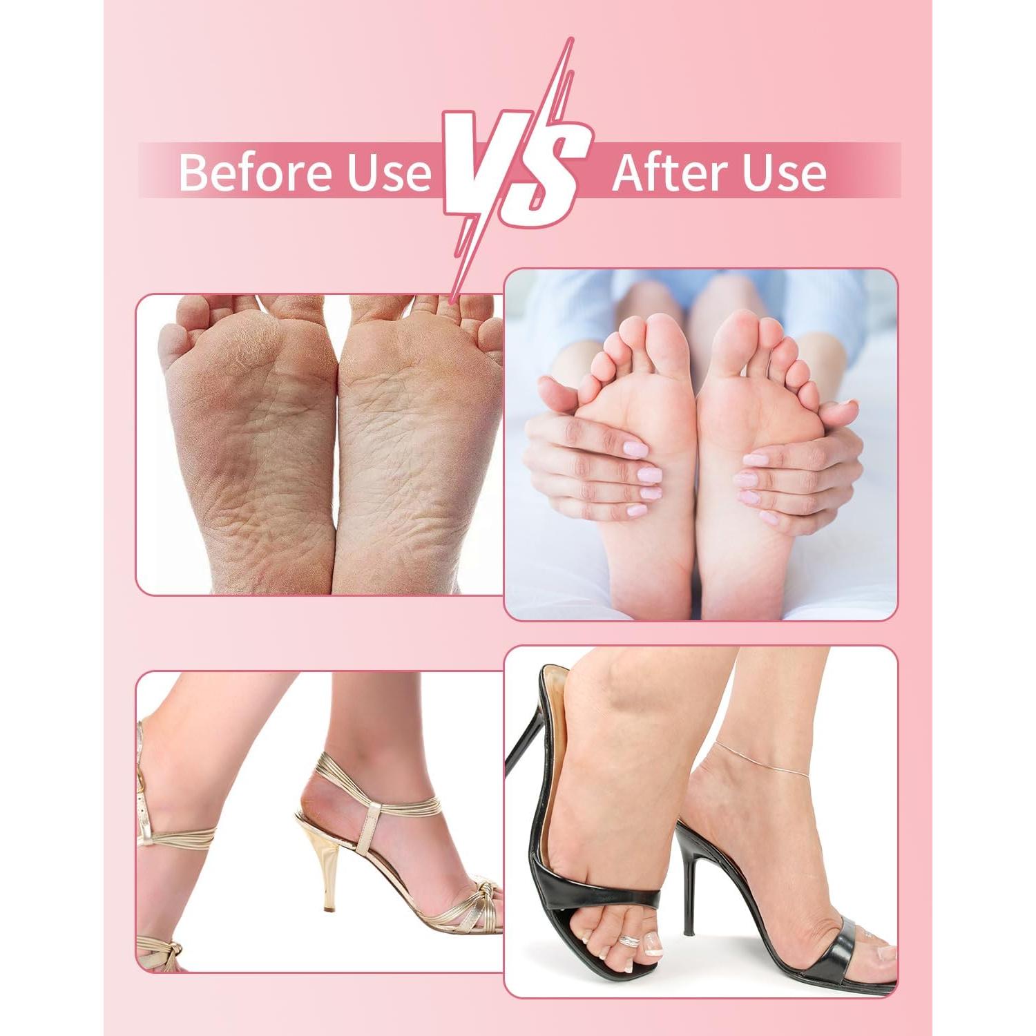 Removedor de Callos Eléctrico Tohecu MY-101 Rosa 12 Velocidades