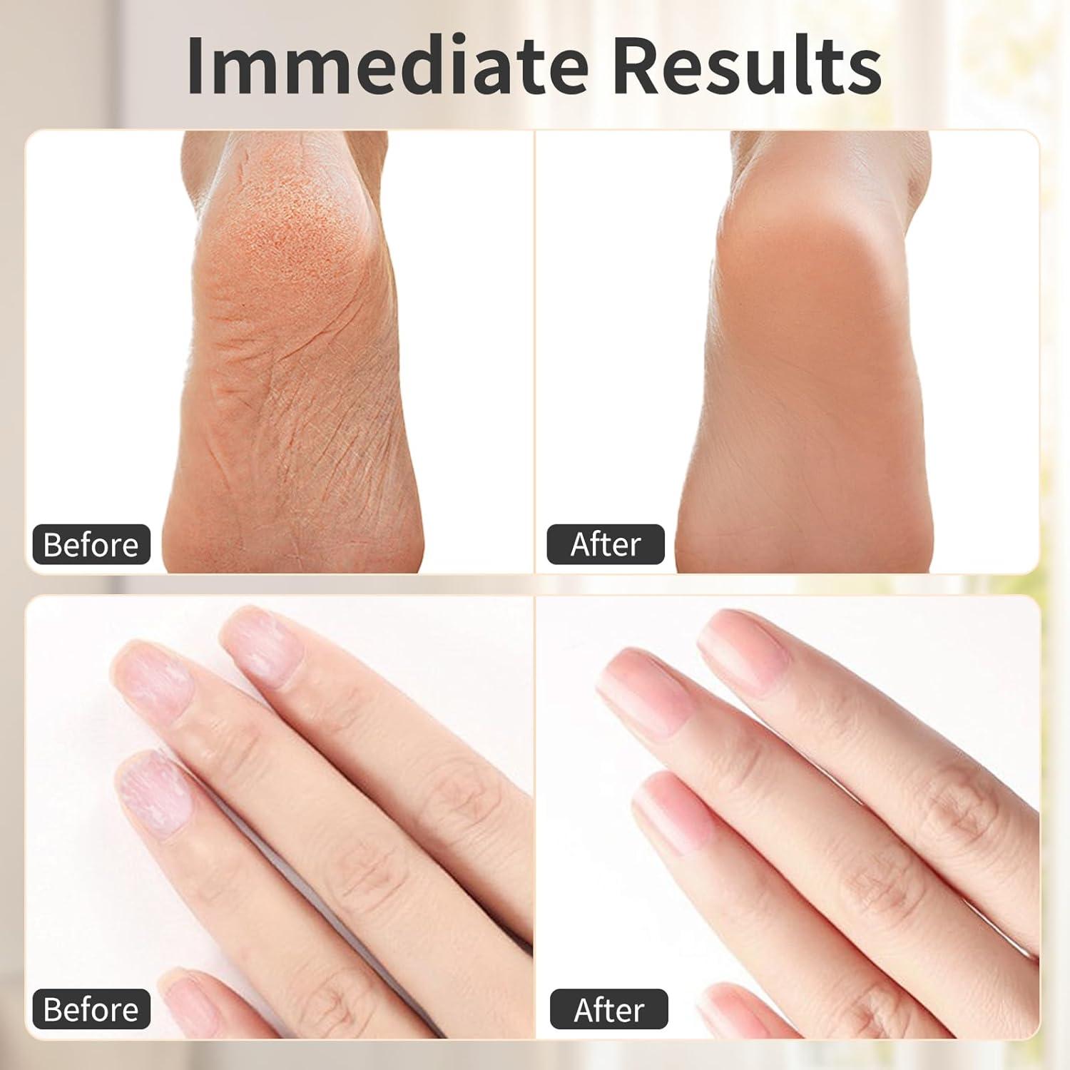 Removedor de Callos Eléctrico FyndAna 2 en 1 Inalámbrico