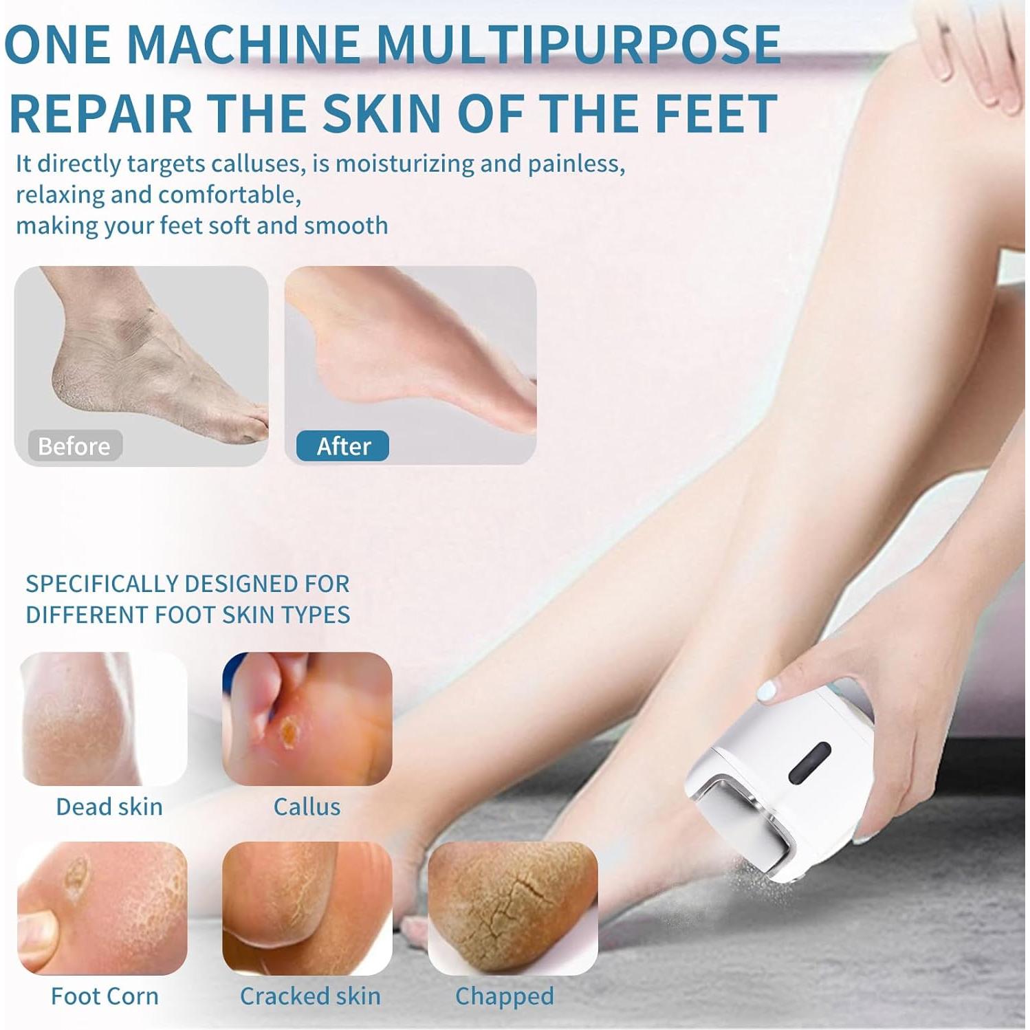 Removedor de Callos Eléctrico YunManHT con Spray y 2 Cabezas