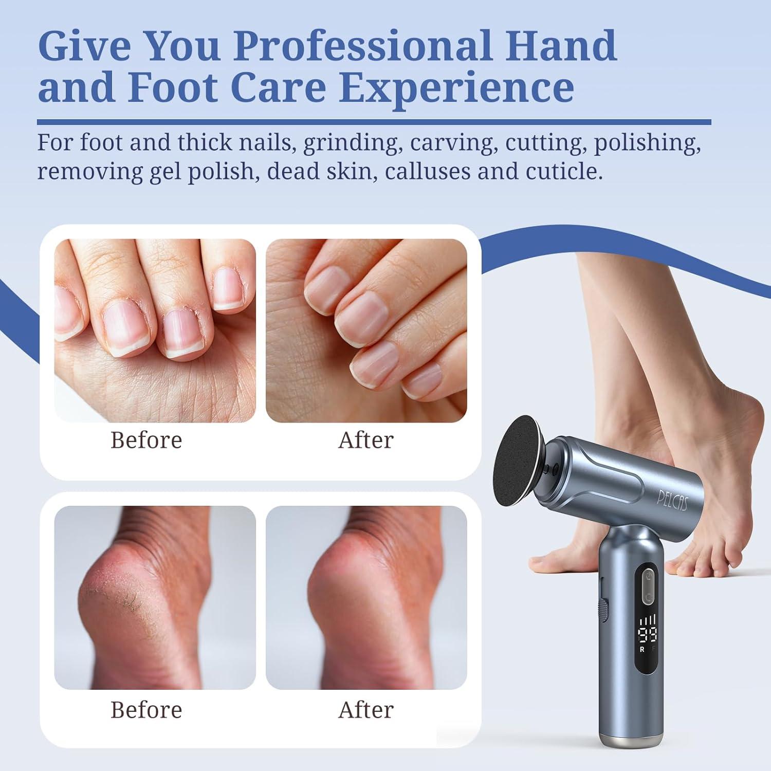 Lima Eléctrica PELCAS para Pies y Uñas 2 en 1 Inalámbrica
