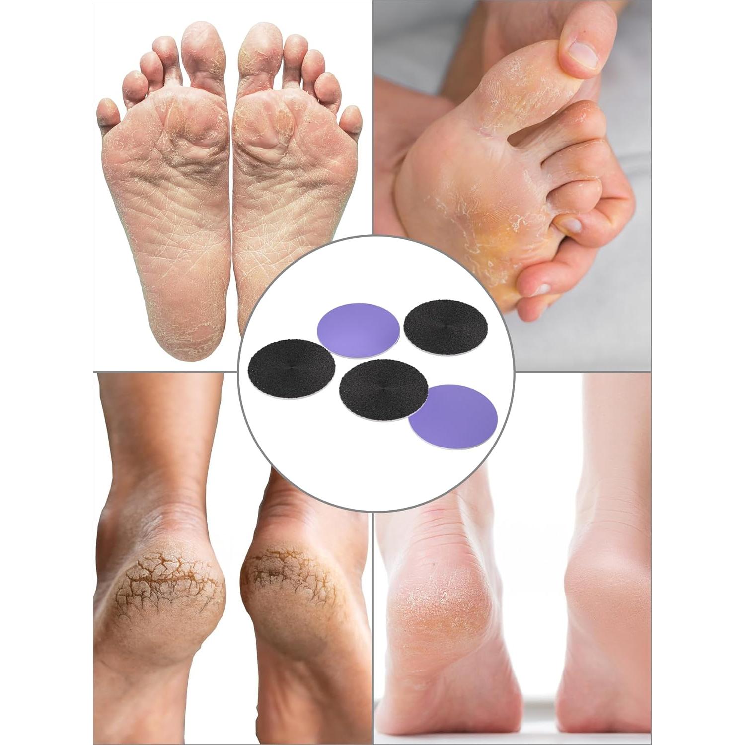 Juego de Papel de Lija 60 Pcs KIUCID 4.2 cm para Pie Eléctrico