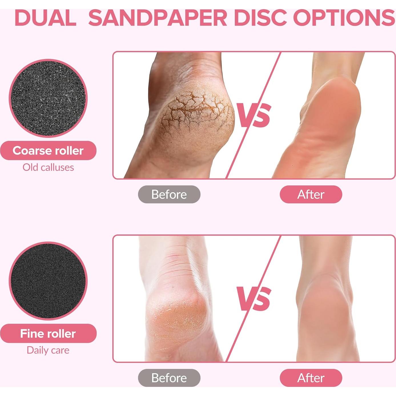 Removedor de Callos Eléctrico 7d24hcare Rosa con 60 Discos