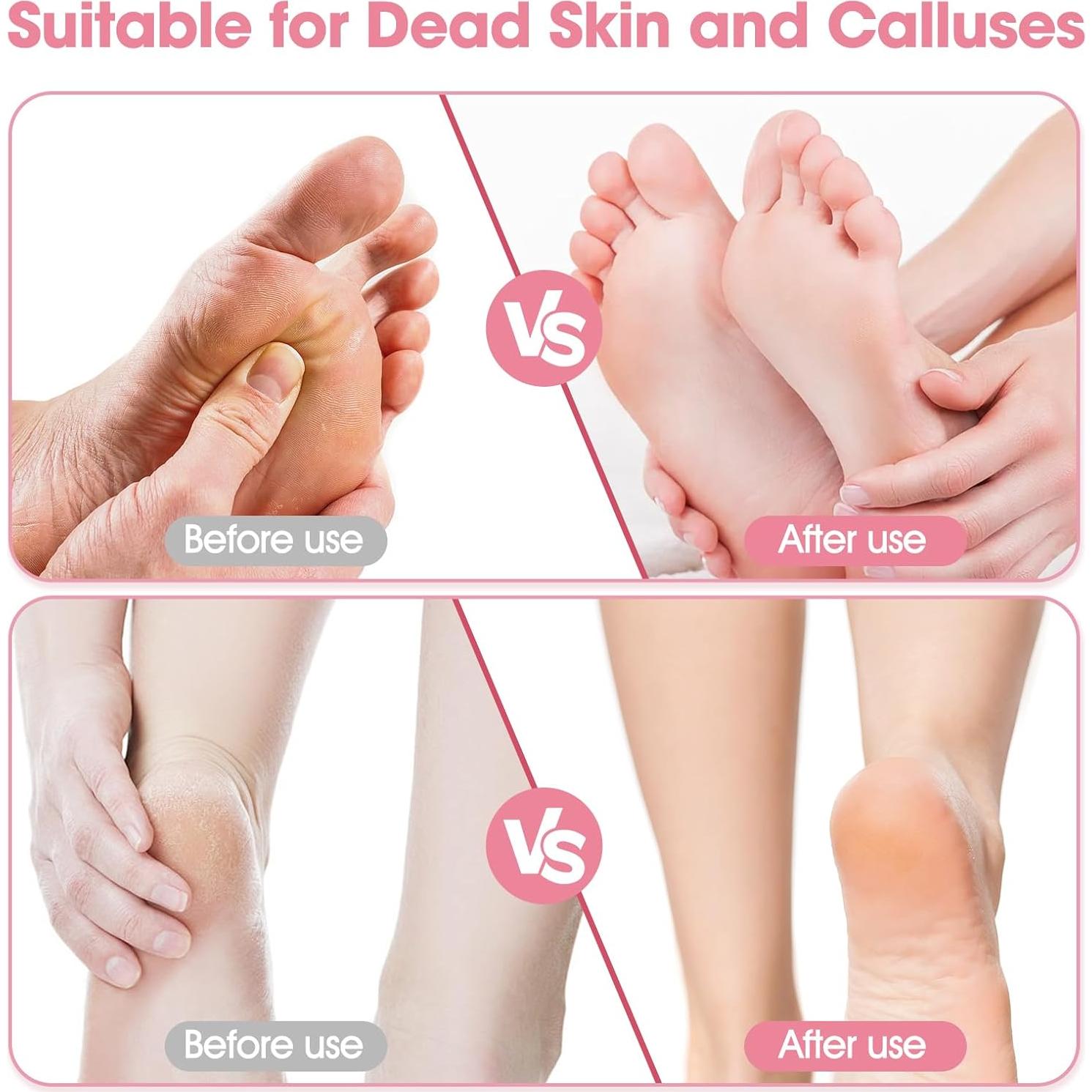 Removedor de Callos Eléctrico Boomluck con 60 Discos de Lija