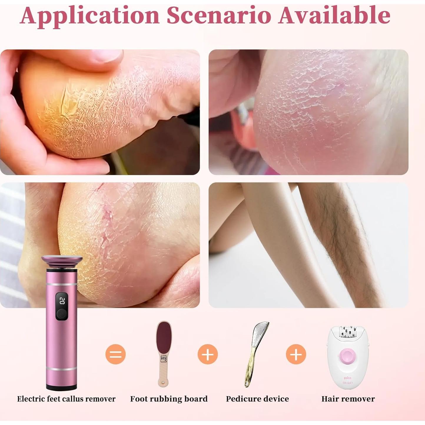 Removedor de Callos Eléctrico Dongnuo con 2 Nano-Cristales