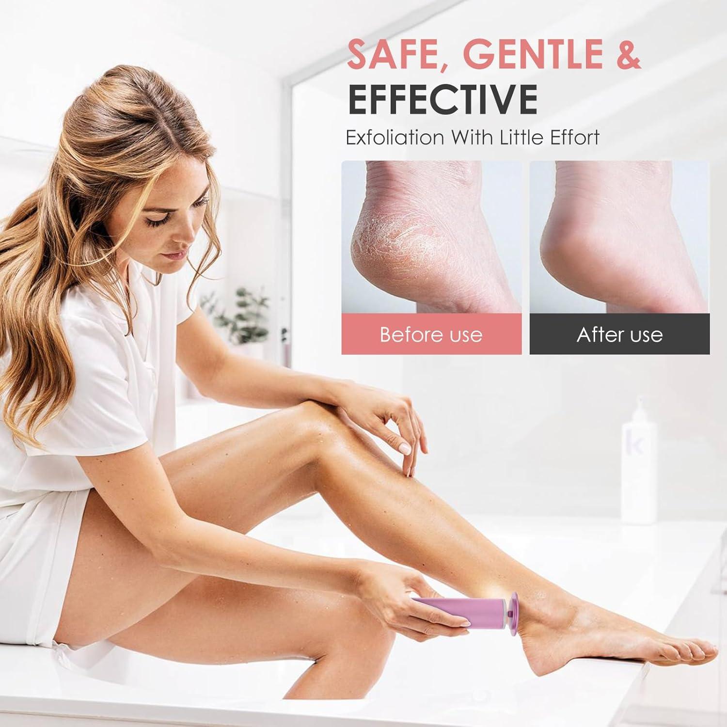 Removedor de Callos Eléctrico ChuangMaiShi con 60 Discos