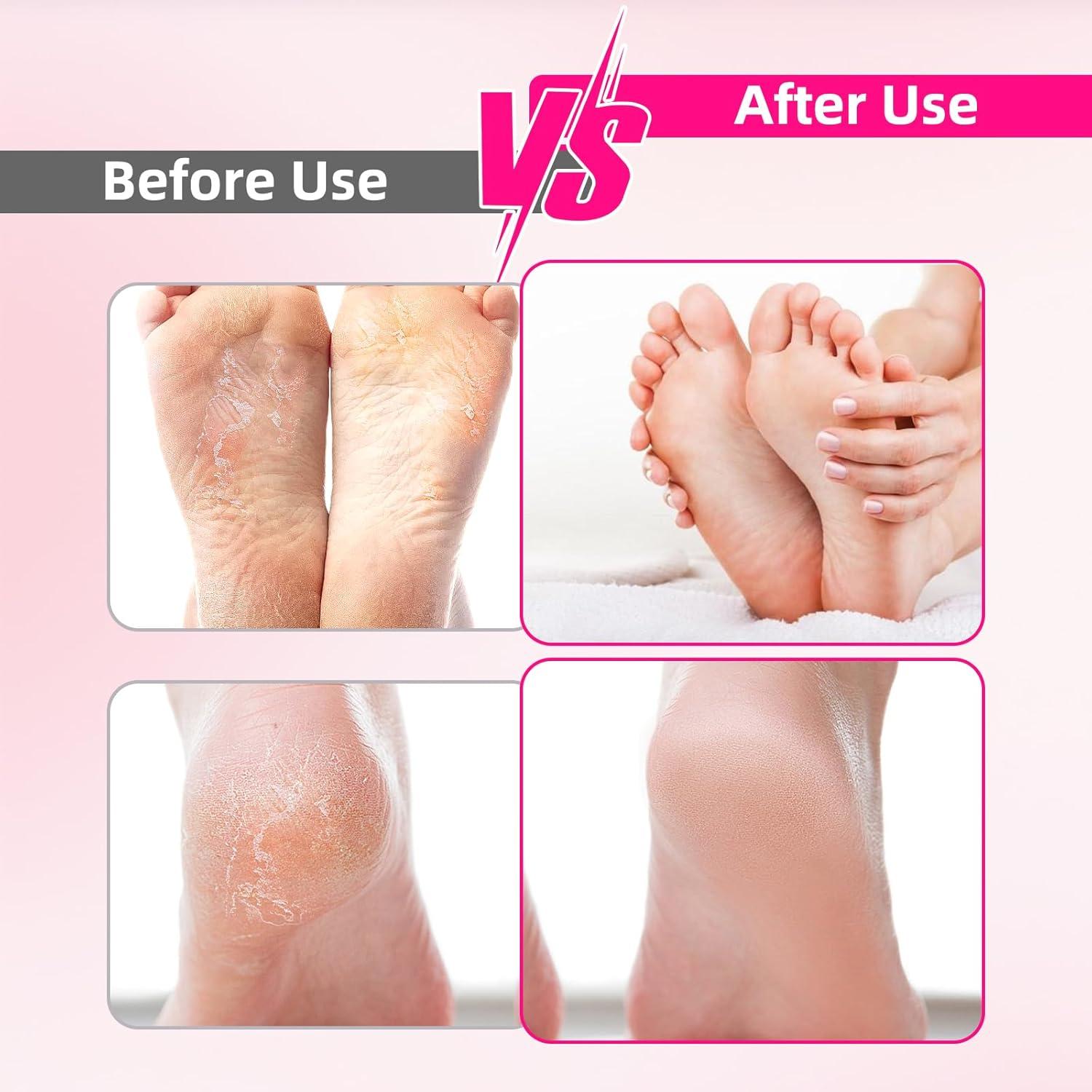 Removedor de Callos Eléctrico GUPAY MSR-802 - 3 Velocidades, 4 Cabezas de Vidrio Nano