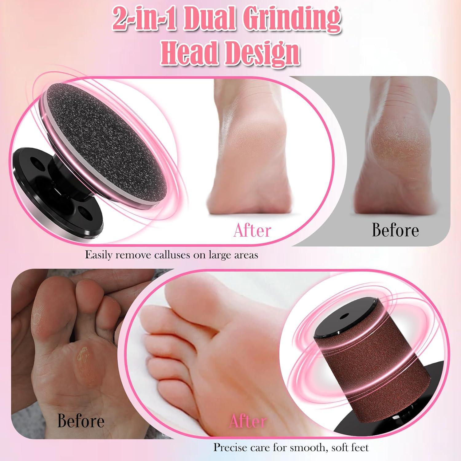 Removedor de Callos Eléctrico FUNKYLEE Oro Rosa 9 Velocidades