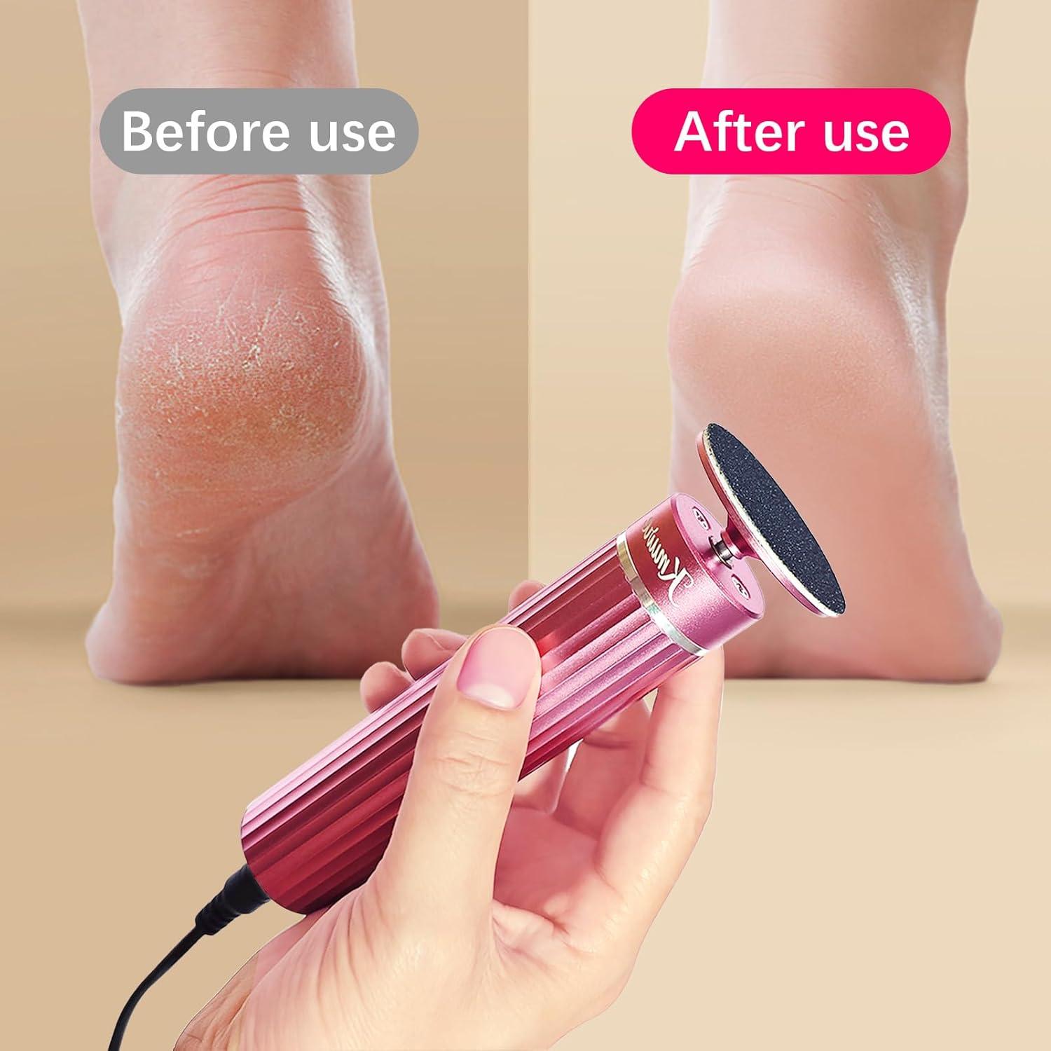 Removedor de Callos Eléctrico Kmure FJ-800R 5.3" Rosa