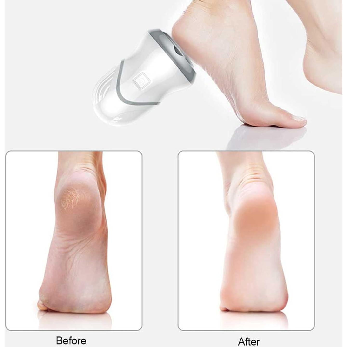 Removedor de Callos Eléctrico ZJchao Portátil Ajustable