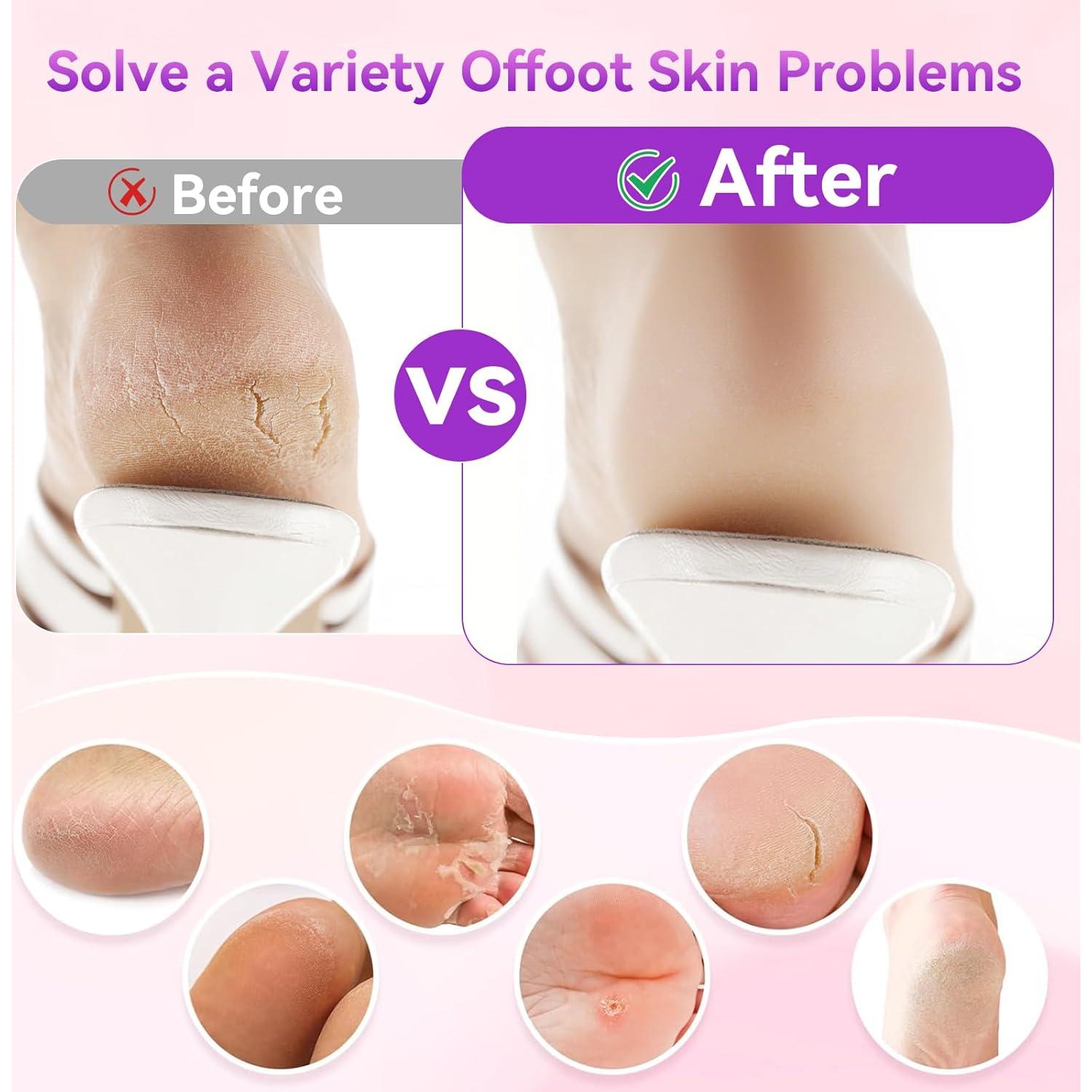 FAMILIFE Eliminador de Callos Eléctrico Recargable con Pantalla LED