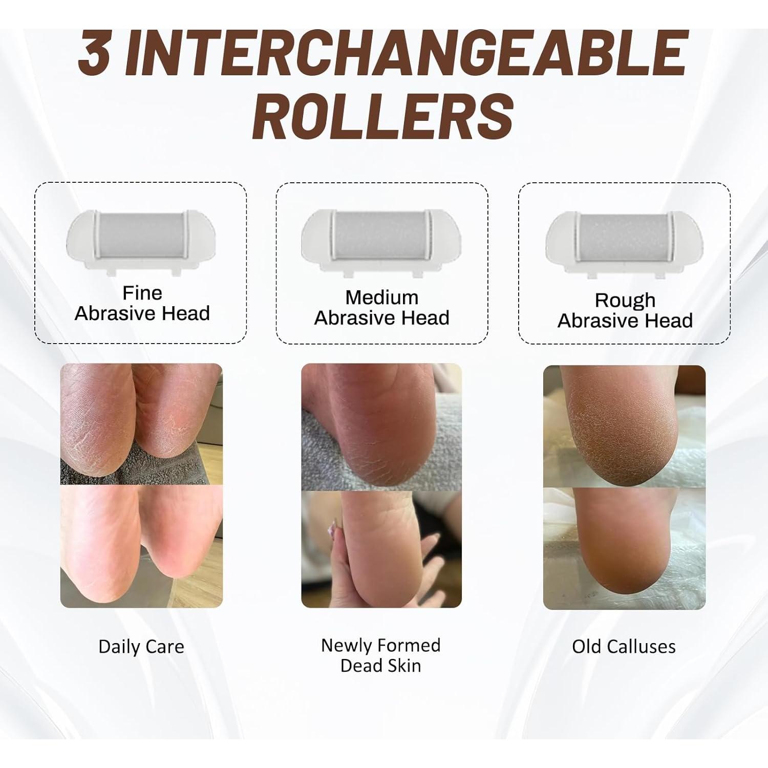 Removedor de Callos Eléctrico SilkGlow XB-513 Recargable Impermeable