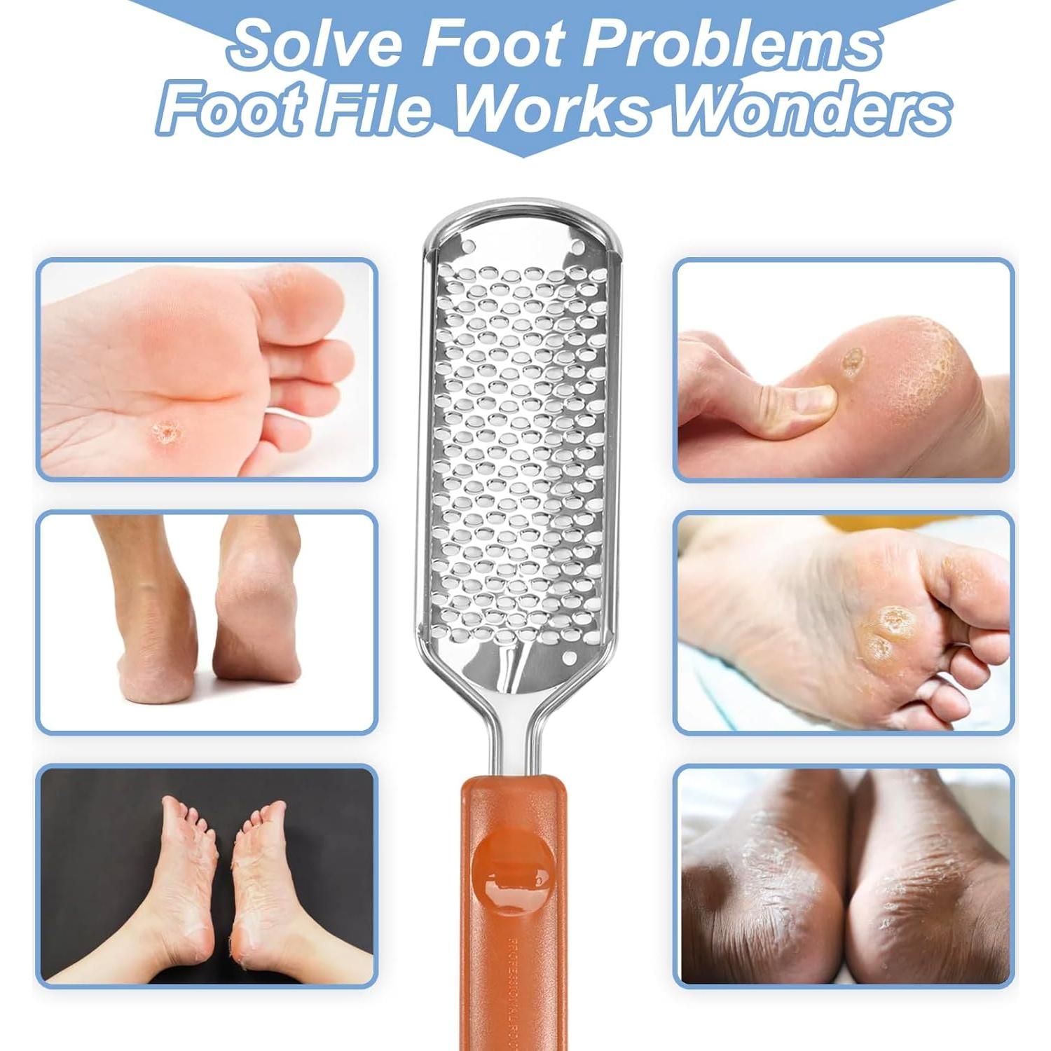 Raspador de pies Untrytb de acero inoxidable 17.99 cm