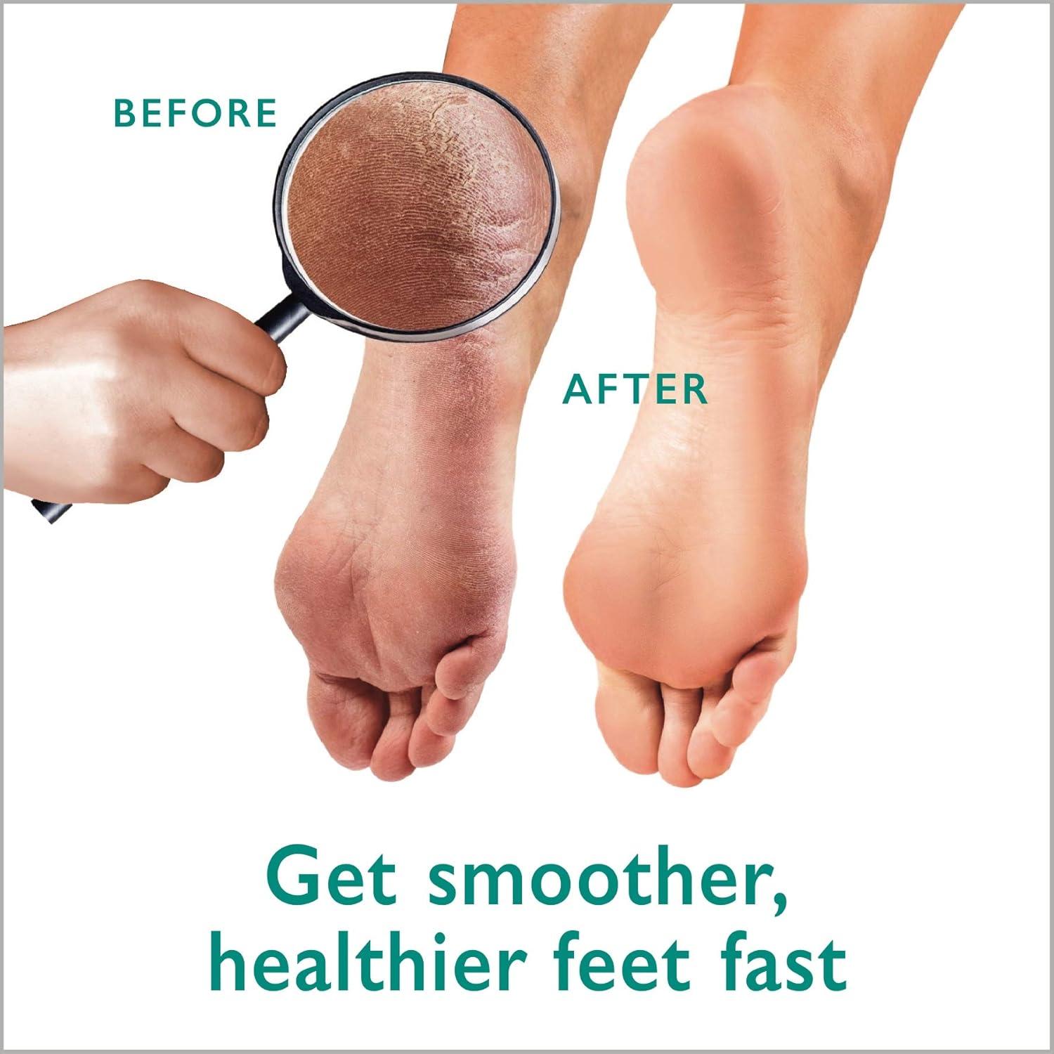 Kit de Pedicura Gilden Tree: Gel de Urea 42% + Exfoliador