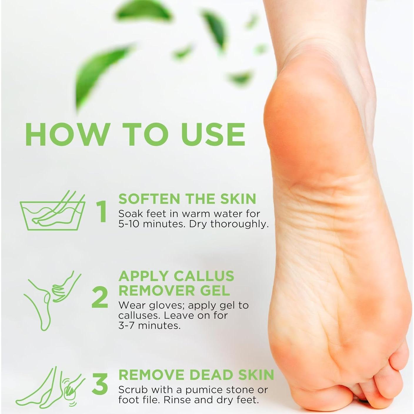 Gel Removedor de Callos Daily Remedy 226.8g - Pies Suaves