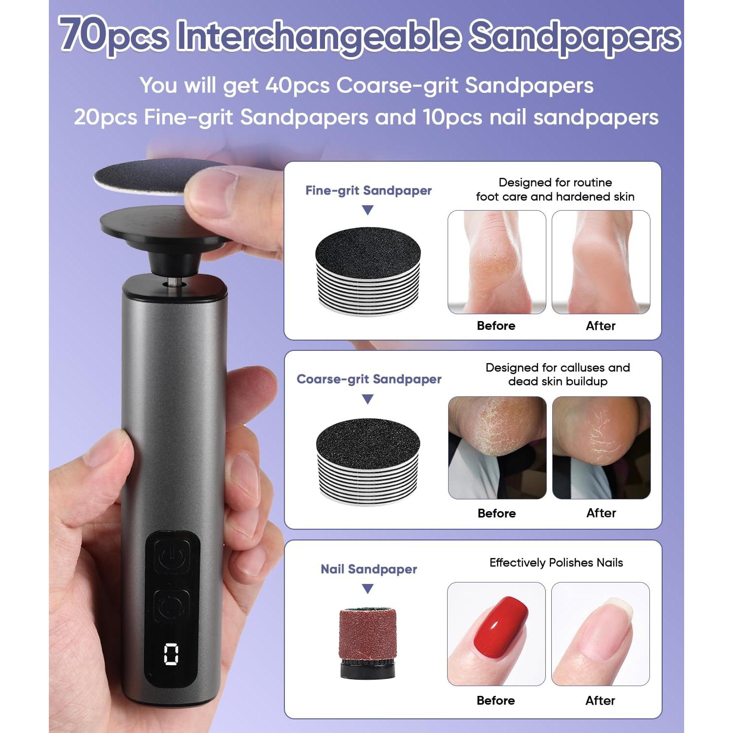 Removedor de Callos Eléctrico 9 Velocidades USB Gris Oscuro