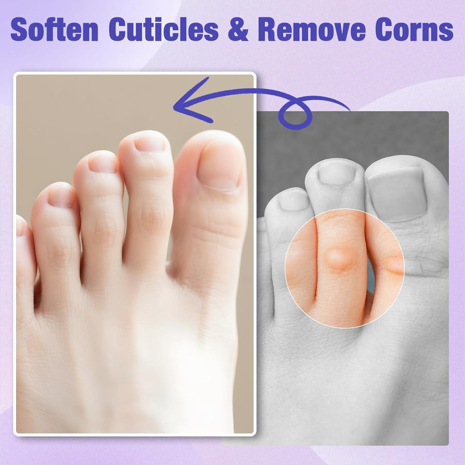 Parches Medicados para Callos QIYANA - 30 Parches 40% Ácido Salicílico