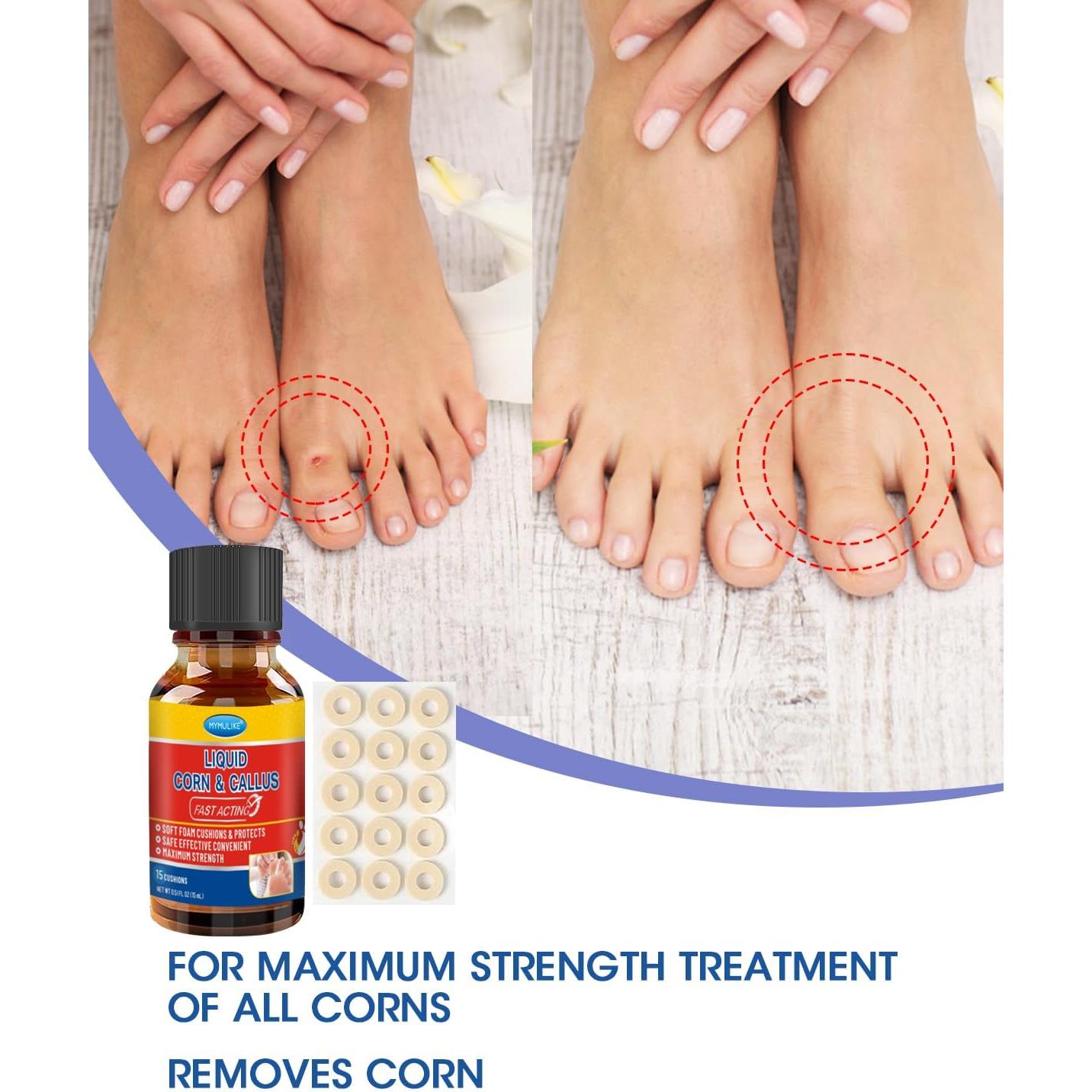 Removedor de Maíz Líquido MYMULIKE 15ml con Aplicadores