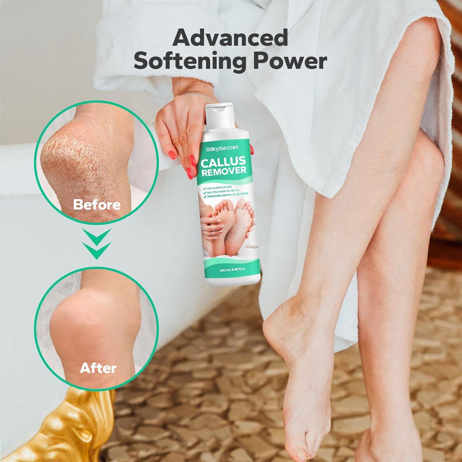 Gel Removedor de Callos SilkySecret 250 ml - Suaviza y Hidrata