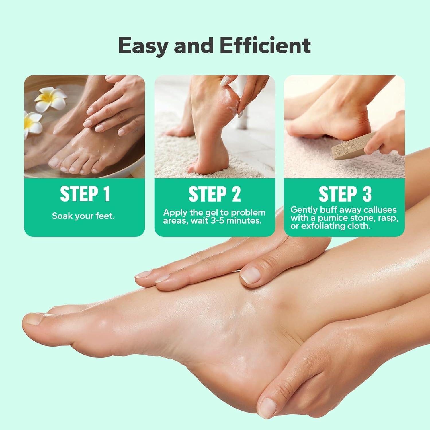 Gel Removedor de Callos SilkySecret 250 ml - Suaviza y Hidrata