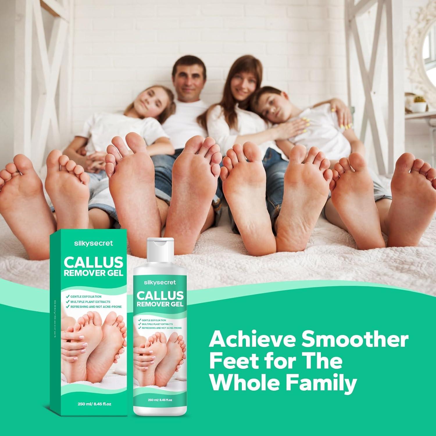 Gel Removedor de Callos SilkySecret 250 ml - Suaviza y Hidrata