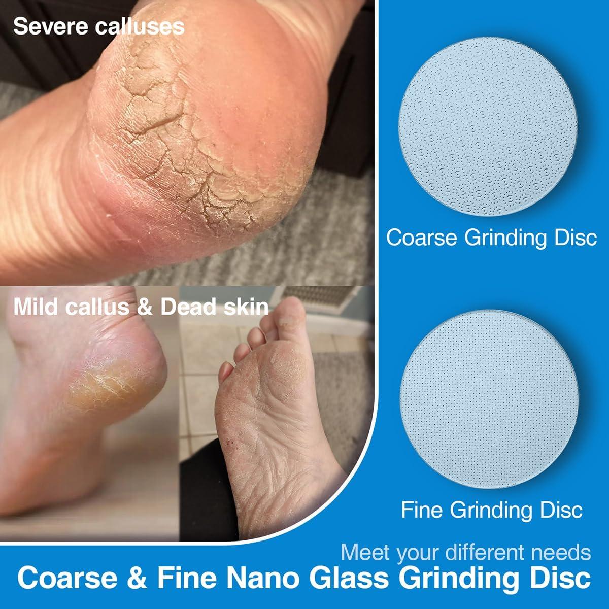 Disco de Lija de Vidrio Nano OZLICE para Removedor de Callos