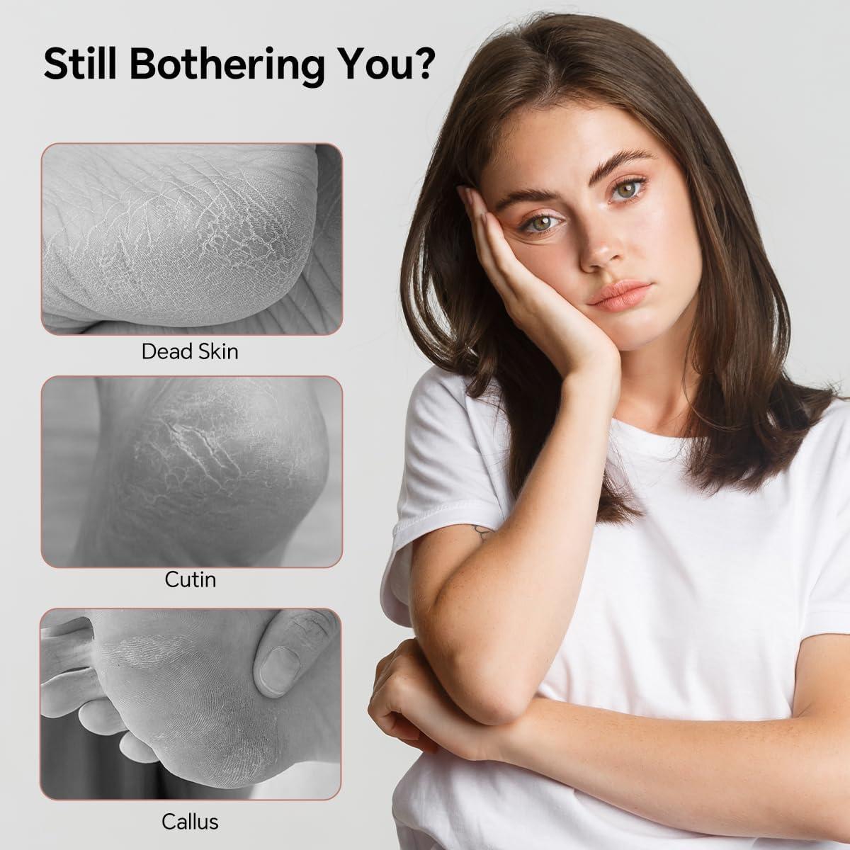 Lima de Pies de Vidrio Nano Lvrzng - Removedor de Callos Doble Cara