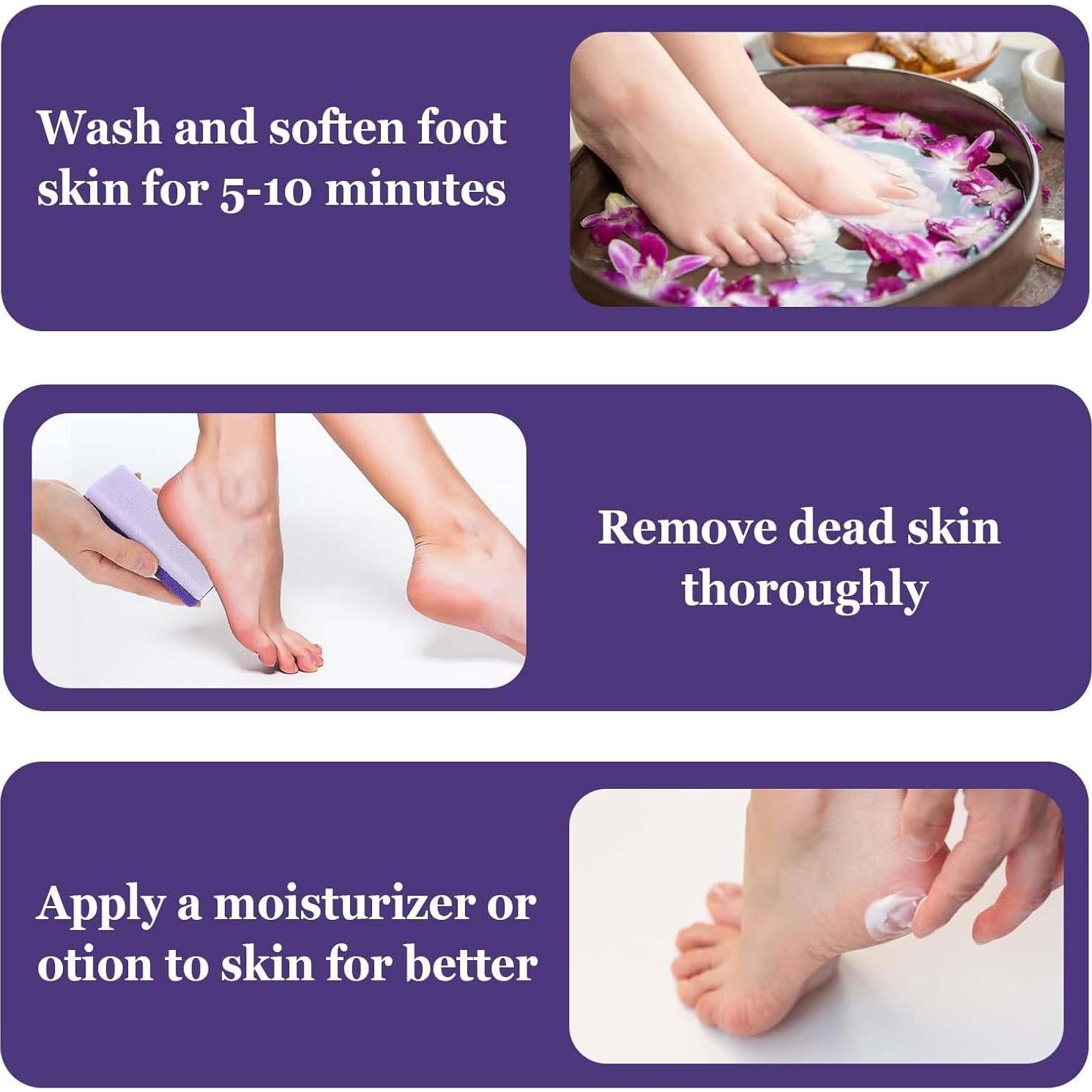 6 Piezas de Piedra Pómez Exfoliante Ptwola para Pies