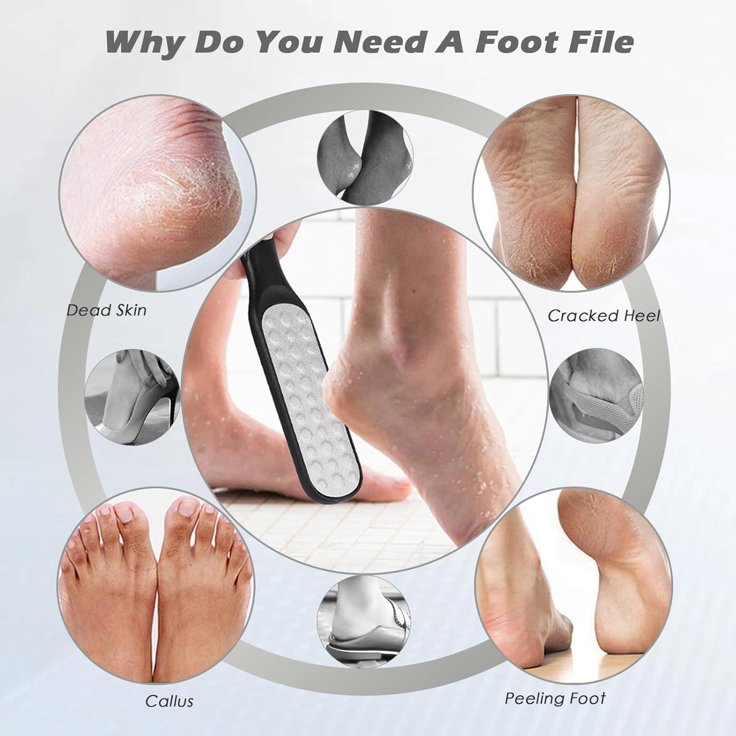 Lima de pies Aenfaiy de acero inoxidable - Removedor de callos