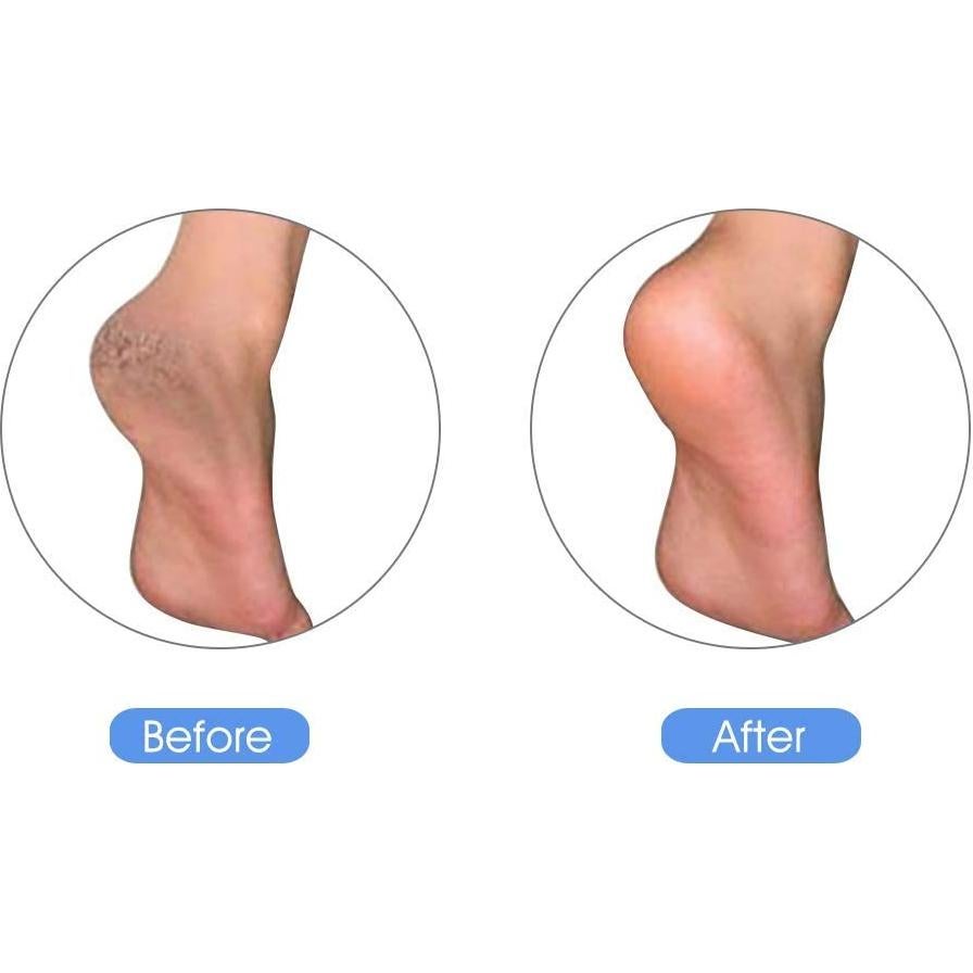 Piedra Pómez Natural KuuCare para Pies - Exfoliante 9.9cm